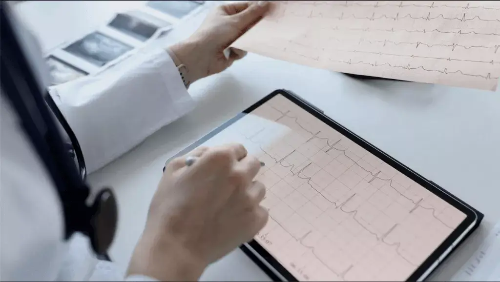 Electrocardiografía Básica. Imagen con fines ilustrativos