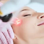 Master Class con Certificación en Láser Fraccionado y Ablativos (Nivel Avanzado para médicos)