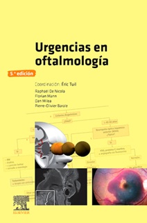 Urgencias en oftalmología